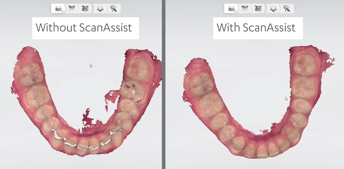 Scan Assist